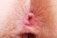 ATK hairy Apricot Pitts Set