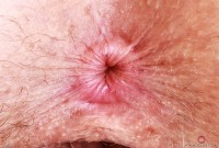 ATK hairy Apricot Pitts Set