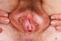 ATK hairy Apricot Pitts in young and hairy