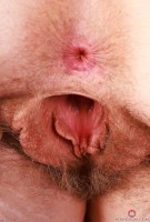 ATK hairy Apricot Pitts Set