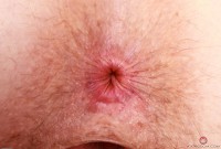 ATK hairy Apricot Pitts Set