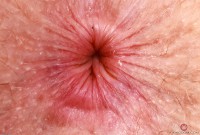 ATK hairy Apricot Pitts in young and hairy
