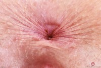 ATK hairy Apricot Pitts Set