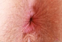 ATK hairy Apricot Pitts in young and hairy