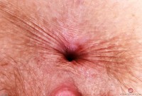 ATK hairy Apricot Pitts Set