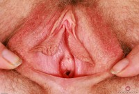 ATK hairy Apricot Pitts Set