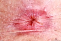 ATK hairy Apricot Pitts Set