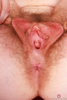 ATK hairy Apricot Pitts Set