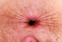 ATK hairy Apricot Pitts in young and hairy