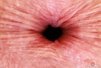 ATK hairy Apricot Pitts Set