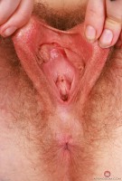 ATK hairy Apricot Pitts in young and hairy