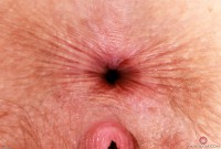 ATK hairy Apricot Pitts Set