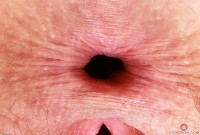 ATK hairy Apricot Pitts Set