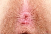 ATK hairy Apricot Pitts Set