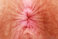 ATK hairy Apricot Pitts Set