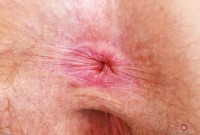 ATK hairy Apricot Pitts Set