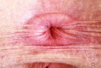 ATK hairy Apricot Pitts Set