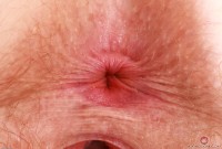 ATK hairy Apricot Pitts in young and hairy