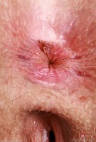 ATK hairy Apricot Pitts Set