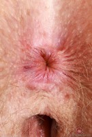 ATK hairy Apricot Pitts Set