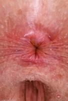 ATK hairy Apricot Pitts Set