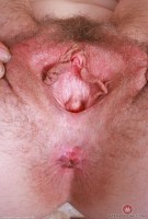 ATK hairy Apricot Pitts Set