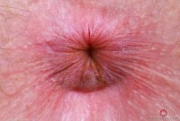 ATK hairy Apricot Pitts Set