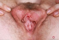 ATK hairy Apricot Pitts Set