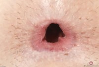 ATK hairy April Dawn Set