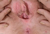 ATK hairy  in young and hairy