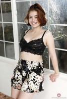 ATK hairy  in young and hairy