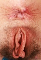 ATK hairy  in mature and hairy