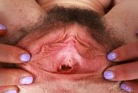 ATK hairy  in mature and hairy