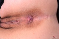 ATK hairy  in young and hairy