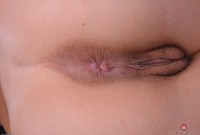 ATK hairy  in young and hairy