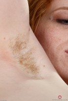 ATK hairy  in young and hairy