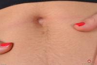 ATK hairy  in young and hairy