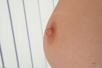 ATK hairy  in young and hairy