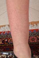 ATK hairy  in young and hairy