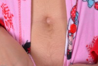 ATK hairy  in young and hairy