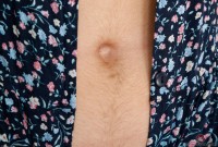 ATK hairy Aali Rousseau Set