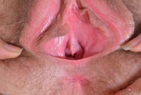 ATK hairy  in young and hairy