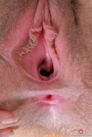 ATK hairy  in young and hairy