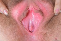 ATK hairy  in young and hairy