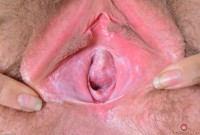 ATK hairy  in young and hairy