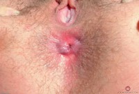 ATK hairy Aali Rousseau Set