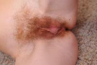 ATK hairy  in mature and hairy