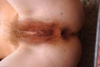 ATK hairy  in mature and hairy