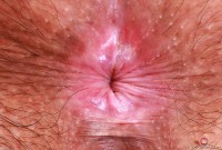 ATK hairy Autumn Berlin Set