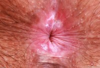 ATK hairy Autumn Berlin Set